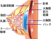 乳腺下法 