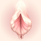 他院で小陰唇縮小手術を受けたが、傷痕やデザインが美しくない場合