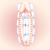 出欠防止のため、タイオーバーを施します